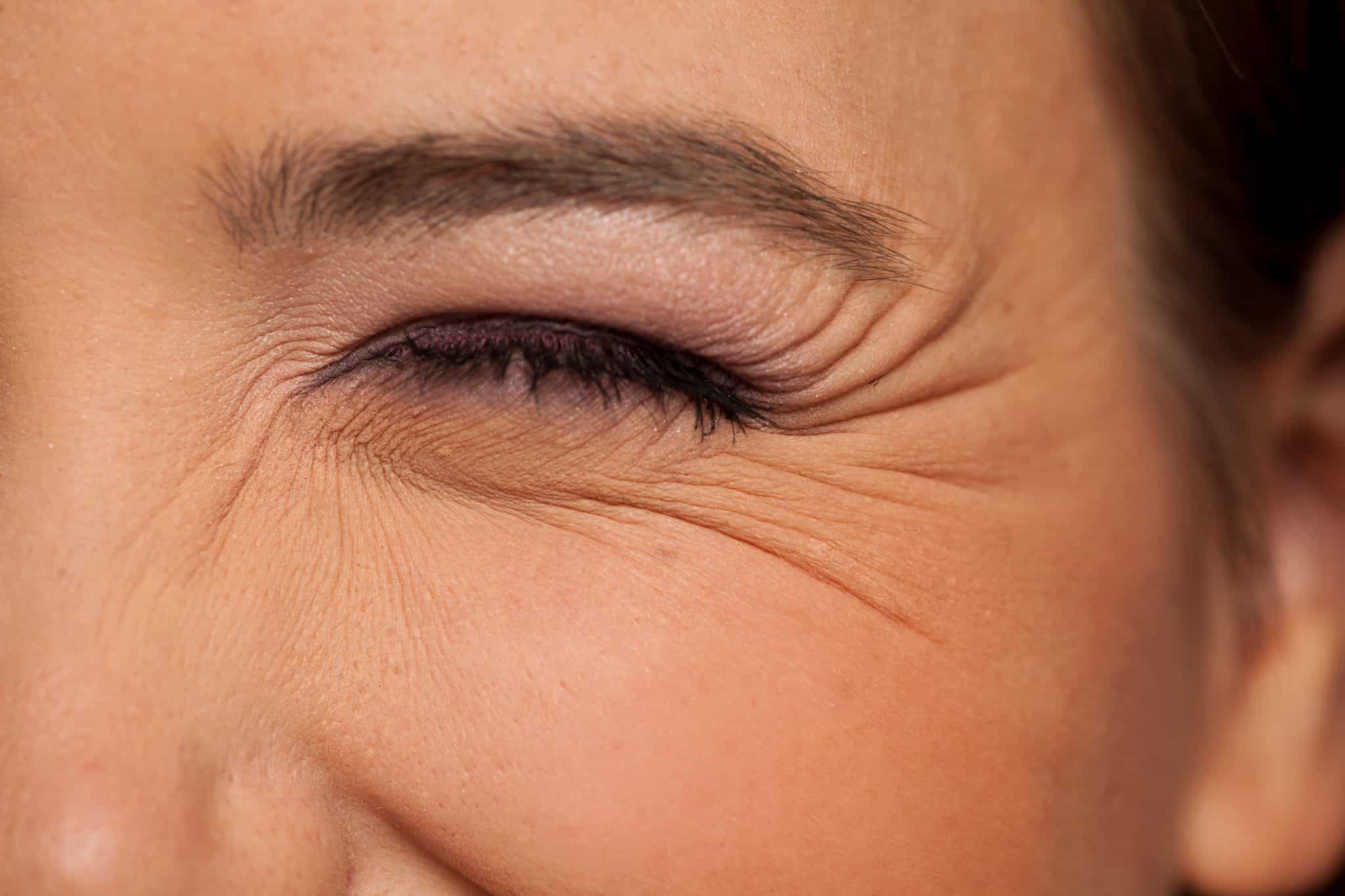 Deusaderm Collagen Fillers - Fine Lines and Wrinkles