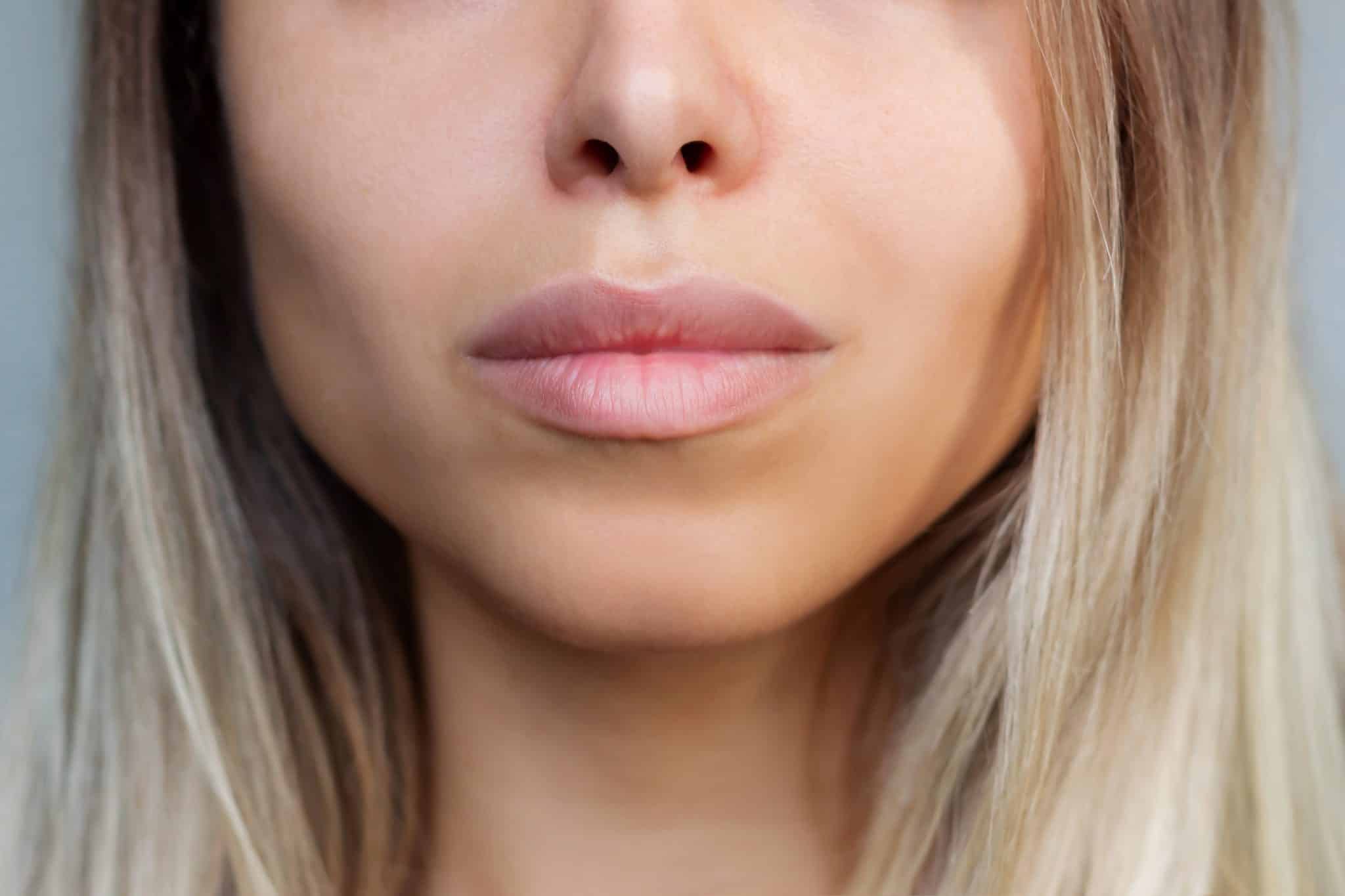 Deusaderm Collagen Fillers - Loss in Face Volume