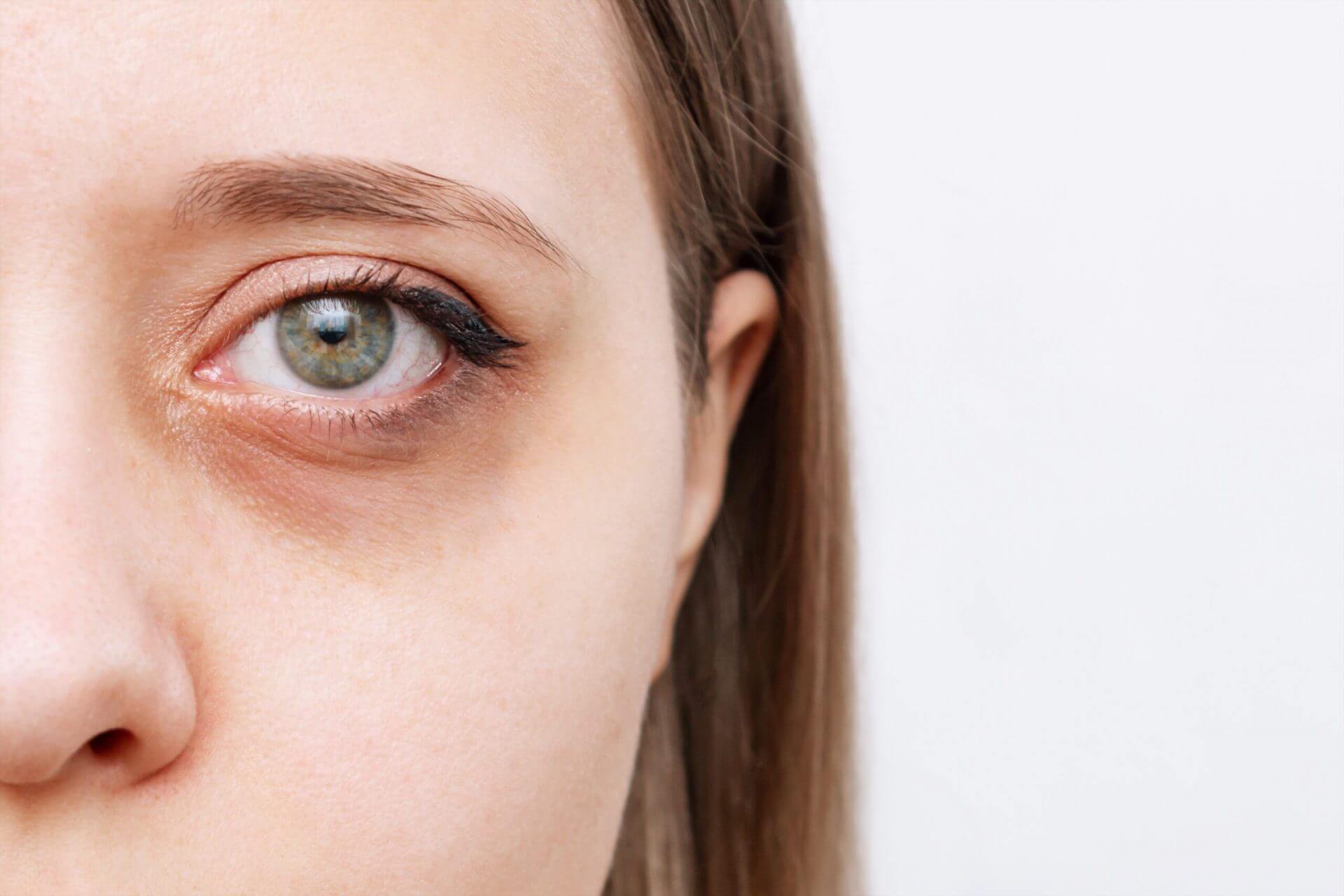Wave Goodbye to Tired-Looking Eyes With This De-Puffing Under-Eye
