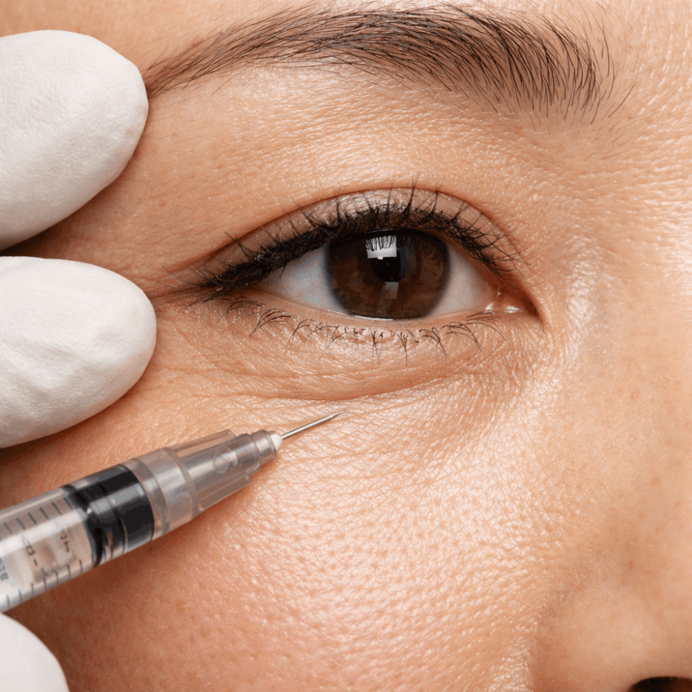 Wrinkle Tox Injection